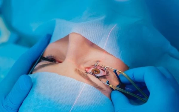 Ingin Operasi Lasik? Perhatikan Beberapa Persyaratan Sebelum Melakukannya
