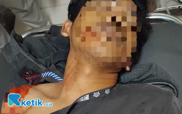 Thumbnail Berita - Seorang Nelayan di Ketapang Daya Diduga Jadi Korban Penganiayaan, Polisi Tidak Tahu