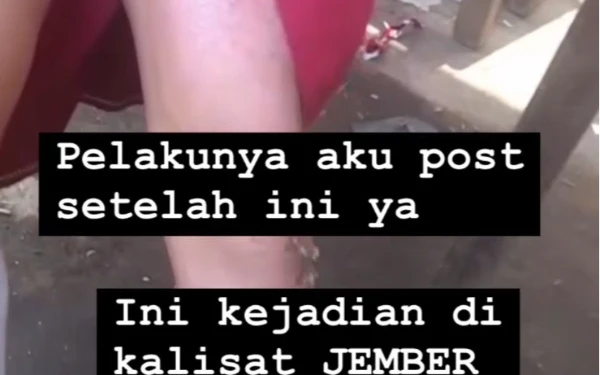 Thumbnail Berita - Bocah SD Perempuan di Jember Alami Luka Bakar Melepuh Akibat Disiram Kuah Bakso, Diduga Korban KDRT Tante