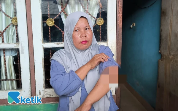 Thumbnail Berita - Begal Sadis Palembang, Tangan Ibu Ini Dicelurit Saat Pertahankan Motornya