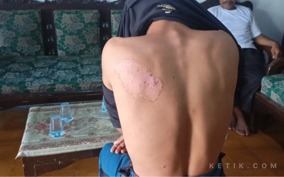 Thumbnail Berita - Keluarga Korban Ungkap Fakta-Fakta Perundungan dan Penganiayaan Santri di Gresik
