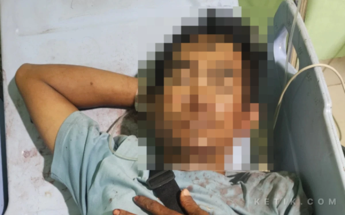 Thumbnail Berita - Pedagang Bakso Keliling di Sorong Dikeroyok, Alami Pendarahan Otak dan Patah Hidung